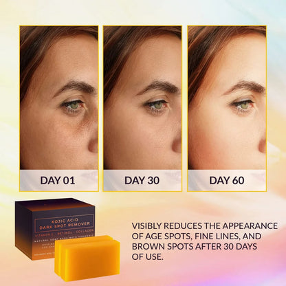 Kojic Acid Dark Spot Removing &amp; Brightening Soap Moisturizer